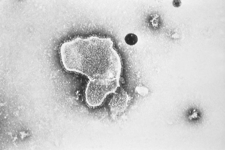 FDA approves first vaccine for RSV, a moment six decades in the making